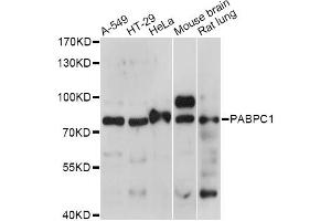 Western blot analysis of extracts of various cell lines, using PABPC1 antibody (ABIN6292221) at 1:1000 dilution. (PABP 抗体)