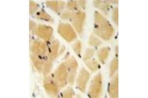 Immunohistochemistry analysis in formalin fixed and paraffin embedded skeletal muscle reacted with GCLM / GLCLR Antibody (C-term) followed by peroxidase conjugation of the secondary antibody and DAB staining. (GCLM 抗体  (C-Term))