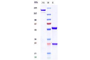 Anti-TREM1 / CD354 Reference Antibody (PY159) on SDS-PAGE under reducing (R) condition. (Recombinant TREM1 抗体)