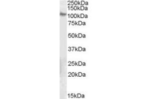 Western Blotting (WB) image for anti-Integrin beta 5 (ITGB5) (C-Term) antibody (ABIN2465852) (Integrin beta 5 抗体  (C-Term))