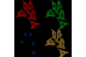 FGFR2 Mouse Monoclonal Antibody staining HepG2 cells by IF/ICC.