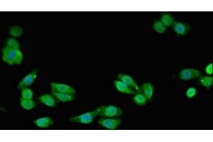 Immunofluorescent analysis of HepG2 cells using ABIN7170866 at dilution of 1:100 and Alexa Fluor 488-congugated AffiniPure Goat Anti-Rabbit IgG(H+L) (SMC4 抗体  (AA 406-501))