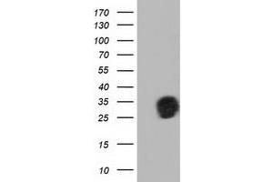 Western Blotting (WB) image for anti-Quinolinate Phosphoribosyltransferase (QPRT) antibody (ABIN1500534) (QPRT 抗体)