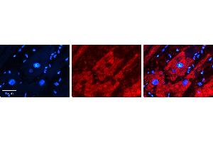 Rabbit Anti-UGT2B4 Antibody   Formalin Fixed Paraffin Embedded Tissue: Human heart Tissue Observed Staining: Cytoplasmic Primary Antibody Concentration: 1:100 Other Working Concentrations: 1:600 Secondary Antibody: Donkey anti-Rabbit-Cy3 Secondary Antibody Concentration: 1:200 Magnification: 20X Exposure Time: 0. (UGT2B4 抗体  (N-Term))