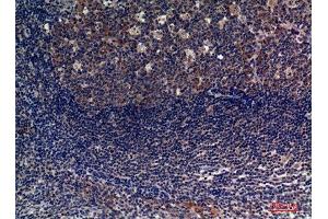 Immunohistochemistry (IHC) analysis of paraffin-embedded Human Tonsils, antibody was diluted at 1:100.