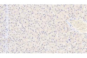 Immunohistochemistry (IHC) image for anti-3-phosphoinositide Dependent Protein Kinase-1 (PDPK1) (AA 83-338) antibody (ABIN7439393)