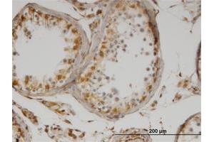 Immunoperoxidase of monoclonal antibody to IL13 on formalin-fixed paraffin-embedded human testis. (IL-13 抗体)