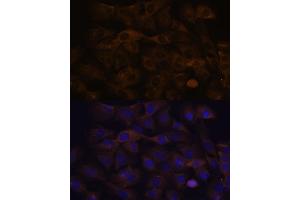Immunofluorescence analysis of C6 cells using GRSF1 antibody (ABIN7267319) at dilution of 1:100. (GRSF1 抗体)