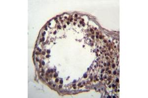 Formalin fixed, paraffin embedded human testis tissue stained with DAZ3 (C-term) followed by peroxidase conjugation of the secondary antibody and DAB staining. (DAZ3 抗体  (C-Term))