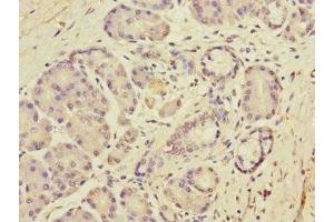 Immunohistochemistry of paraffin-embedded human pancreatic tissue using ABIN7150689 at dilution of 1:100 (DUOX1 抗体  (AA 1312-1551))