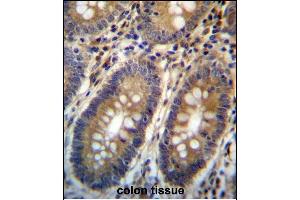 ASMTL Antibody (Center) (ABIN657160 and ABIN2846294) immunohistochemistry analysis in formalin fixed and paraffin embedded human colon tissue followed by peroxidase conjugation of the secondary antibody and DAB staining. (ASMTL 抗体  (AA 231-259))