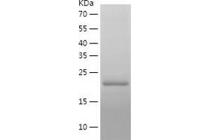 PPIA Protein (AA 1-164) (His tag)