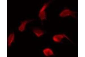 ABIN6275530 staining HepG2 by IF/ICC. (NEK5 抗体  (Internal Region))