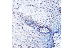 Immunohistochemistry of paraffin-embedded human esophageal using MMP3 Rabbit mAb (ABIN7268424) at dilution of 1:100 (40x lens). (MMP3 抗体)