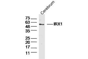 Mouse Cerebrum lysates probed with IRX1 Polyclonal Antibody, Unconjugated  at 1:300 dilution and 4˚C overnight incubation. (IRX1 抗体  (AA 401-480))