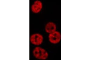 ABIN6276566 staining  Hela cells by IF/ICC. (NEDD8 抗体  (Internal Region))