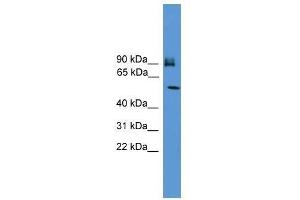Western Blot showing OSBPL11 antibody used at a concentration of 1-2 ug/ml to detect its target protein. (OSBPL11 抗体  (C-Term))