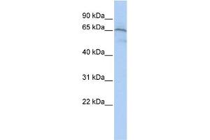 WB Suggested Anti-AIFM1  Antibody Titration: 0. (AIF 抗体  (Middle Region))
