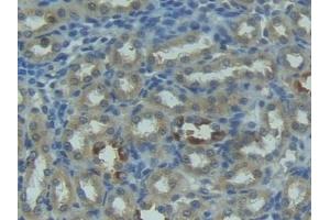 Detection of FASL in Rat Kidney Tissue using Polyclonal Antibody to Factor Related Apoptosis Ligand (FASL) (FASL 抗体  (AA 100-278))