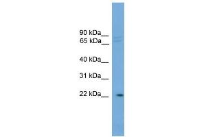 WB Suggested Anti-HOM-TES-103 Antibody Titration: 0. (IFFO1 抗体  (C-Term))