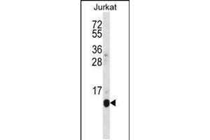 Western blot analysis in Jurkat cell line lysates (35ug/lane). (POLR2G 抗体  (C-Term))