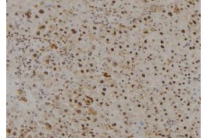 ABIN6278938 at 1/100 staining Mouse liver tissue by IHC-P. (MYST3 抗体  (N-Term))