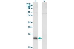 Western Blot analysis of NPHP1 expression in transfected 293T cell line by NPHP1 MaxPab polyclonal antibody. (NPHP1 抗体  (AA 1-121))