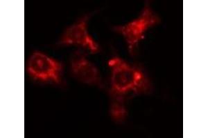 ABIN6275626 staining HepG2 cells by IF/ICC. (CCT6A 抗体  (Internal Region))