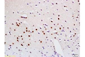 Formalin-fixed and paraffin embedded mouse brain labeled with Anti-Sema3A Polyclonal Antibody, Unconjugated  at 1:200 followed by conjugation to the secondary antibody and DAB staining. (SEMA3A 抗体  (AA 22-120))