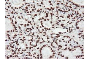 Image no. 1 for anti-F-Box Protein 21 (FBXO21) antibody (ABIN1498233) (FBXO21 抗体)