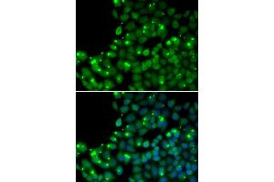 Immunofluorescence analysis of U2OS cells using MGMT antibody (ABIN5970267). (MGMT 抗体)