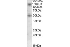 Western Blotting (WB) image for anti-Ring Finger Protein 139 (RNF139) (C-Term) antibody (ABIN2466775) (RNF139 抗体  (C-Term))