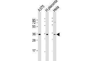 All lanes : Anti-FGF5 Antibody (N-Term) at 1:2000 dilution Lane 1:  whole cell lysate Lane 2: human placenta lysate Lane 3: Hela whole cell lysate Lysates/proteins at 20 μg per lane. (FGF5 抗体  (AA 140-172))