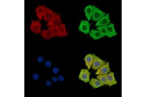 ABIN7096233 and ABIN7100295 staining Hela cells by IF/ICC.