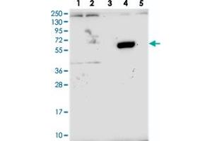 Western blot analysis of Lane 1: RT-4, Lane 2: U-251 MG, Lane 3: Human Plasma, Lane 4: Liver, Lane 5: Tonsil with ZNF837 polyclonal antibody  at 1:250-1:500 dilution. (ZNF837 抗体)