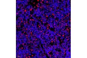 Immunofluorescence of paraffin embedded rat thymus using Skar (ABIN7074970) at dilution of 1:950 (400x lens) (p46 抗体)