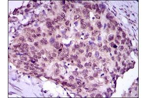 Immunohistochemistry (IHC) image for anti-Myocyte Enhancer Factor 2C (MEF2C) (AA 1-125) antibody (ABIN1846463) (MEF2C 抗体  (AA 1-125))