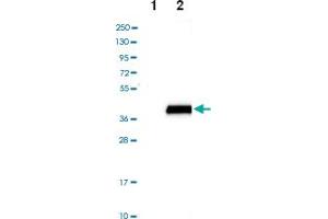 Western blot analysis of Lane 1: Negative control (vector only transfected HEK293T lysate), Lane 2: Over-expression lysate (Co-expressed with a C-terminal myc-DDK tag (~3. (SULT4A1 抗体)