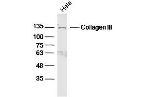 Western Blotting (WB) image for anti-Collagen, Type III (COL3) (AA 801-900) antibody (ABIN730168)