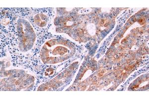 Immunohistochemistry (IHC) image for anti-B-Cell CLL/lymphoma 2 (BCL2) (AA 2-211) antibody (ABIN7432577)
