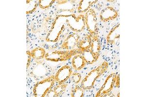 Immunohistochemistry of paraffin embedded human kidney using SLC22A12 (ABIN7075662) at dilution of 1:2100 (300x lens) (SLC22A12 抗体)