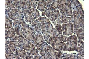 Image no. 1 for anti-Mitogen-Activated Protein Kinase 13 (MAPK13) antibody (ABIN1499952) (MAPK13 抗体)
