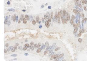 Immunohistochemistry (IHC) image for anti-Cleavage Stimulation Factor, 3' Pre-RNA, Subunit 2, 64kDa, tau Variant (CSTF2T) (AA 566-616) antibody (ABIN7454755)