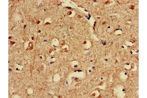 Immunohistochemistry (IHC) image for anti-Sprouty-Related, EVH1 Domain Containing 1 (SPRED1) (AA 123-311) antibody (ABIN7170645)