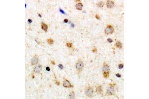 Immunohistochemical analysis of GPR126 staining in human brain formalin fixed paraffin embedded tissue section. (G Protein-Coupled Receptor 126 抗体)