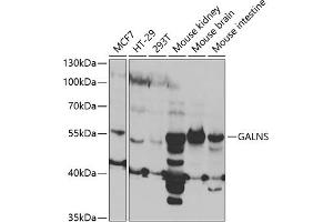 Western blot analysis of extracts of various cell lines, using GALNS antibody (ABIN6131691, ABIN6140937, ABIN6140938 and ABIN6221120) at 1:1000 dilution. (GALNS 抗体  (AA 353-522))