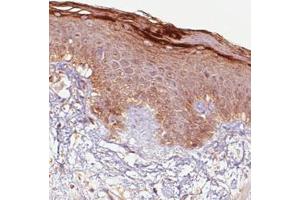 Immunohistochemical staining (Formalin-fixed paraffin-embedded sections) of human skin with RNASE7 monoclonal antibody, clone CL0224  shows immunoreactivity in keratinocytes, particularly strong in the outer layer. (RNASE7 抗体)