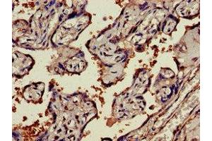 Immunohistochemistry (IHC) image for anti-Nicotinamide phosphoribosyltransferase (NAMPT) (AA 1-280) antibody (ABIN7161574)