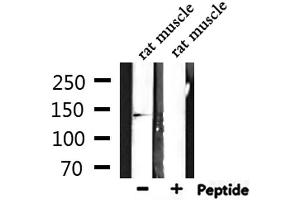Western blot analysis of extracts from rat muscle, using RNF123 Antibody. (RNF123 抗体  (N-Term))