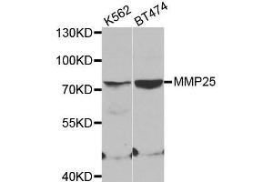 Western blot analysis of extracts of various cell lines, using MMP25 antibody. (MMP25 抗体)